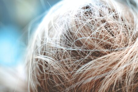 Der Unterschied zwischen FUE- und FUT-Haartransplantationen