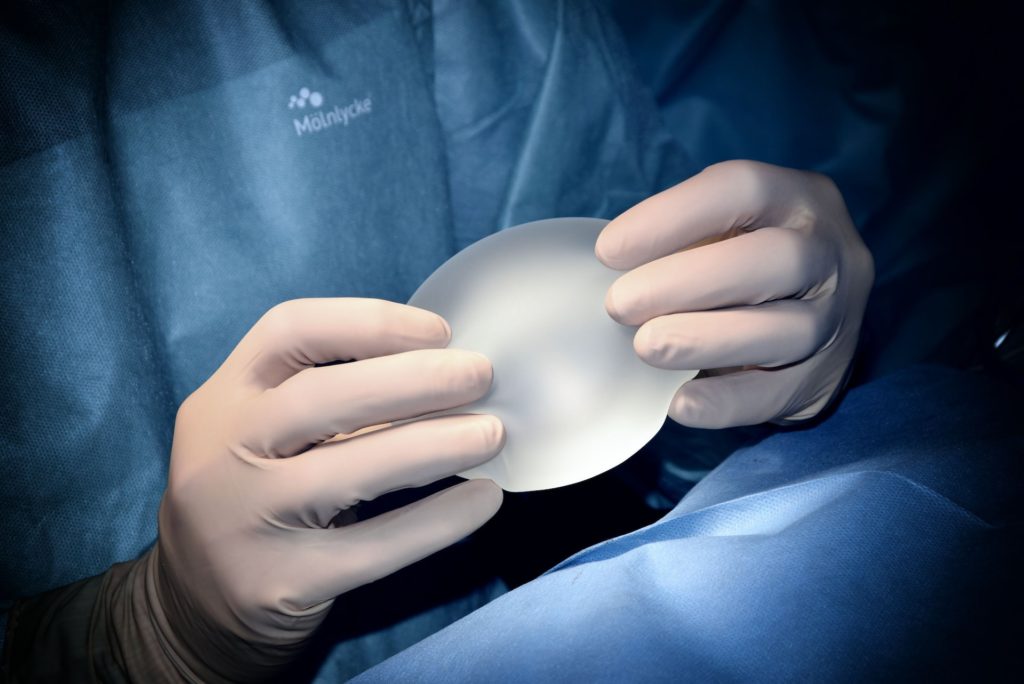 Brustvergrößerung mit Implantaten aus Silikon